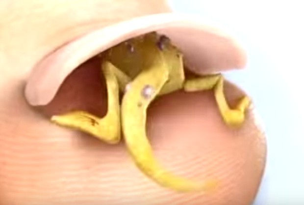 Lamisil - It's Alive (2003, USA) - YouTube.clipular